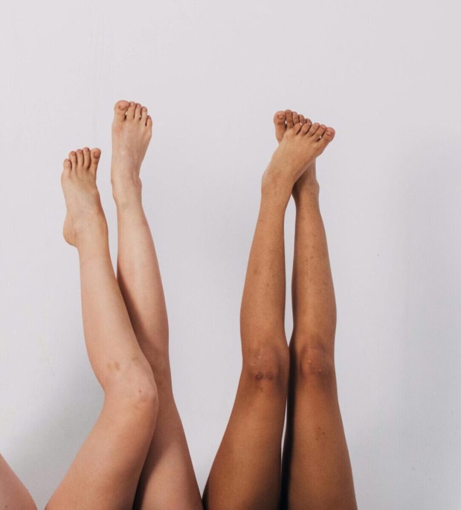 Four pairs of legs raised against a white background symbolizing diversity.